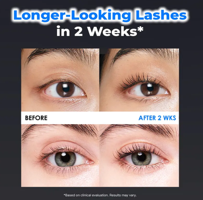 Essential Eyelash Growth Serum – Fuller & Thicker Lashes | Jumbo 0.5 fl.oz | Safe, Gentle & Non-Prostaglandin Formula